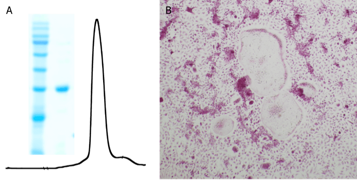 LifeTein Recombinant RANKL Recombinant RANKL Protein
